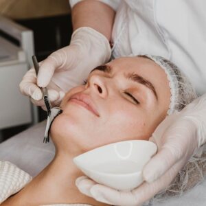 chemical peel chemical peel