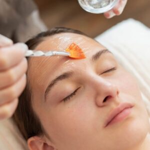 chemical peel chemical peel