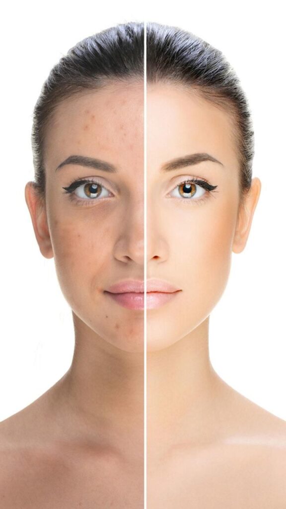 Non-Surgical Anti-Ageing Treatments – Safe & Effective Skin Rejuvenation