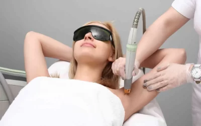 A dermatologist performing laser hair reduction treatment at SkinMD Clinic, Pune — using advanced laser technology for safe, long-lasting hair reduction.
