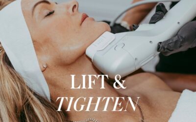 Dermatologist performing laser skin tightening treatment on face