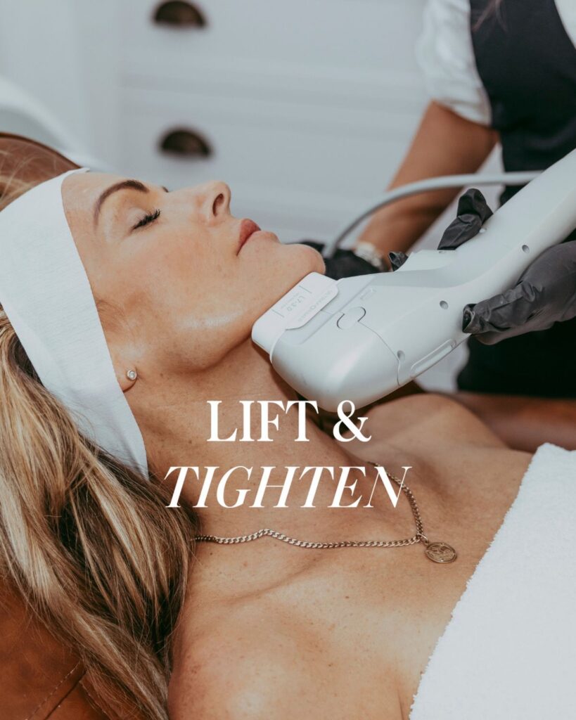 Dermatologist performing laser skin tightening treatment on face