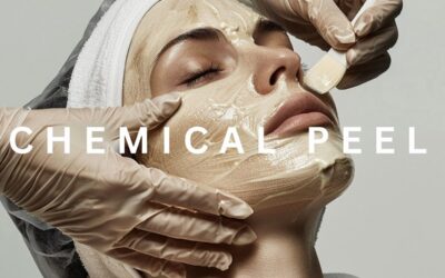 Chemical peel treatment for different skin types by dermatologist
